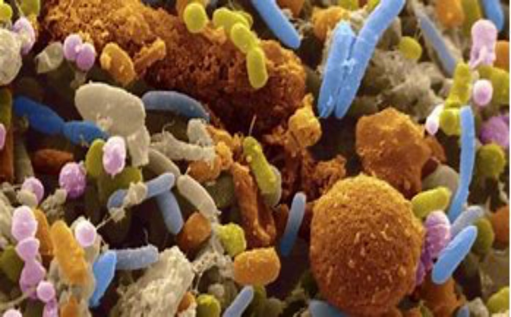 bactéries-intestinale-bon-microbiote-humeur-alimentation-drosana